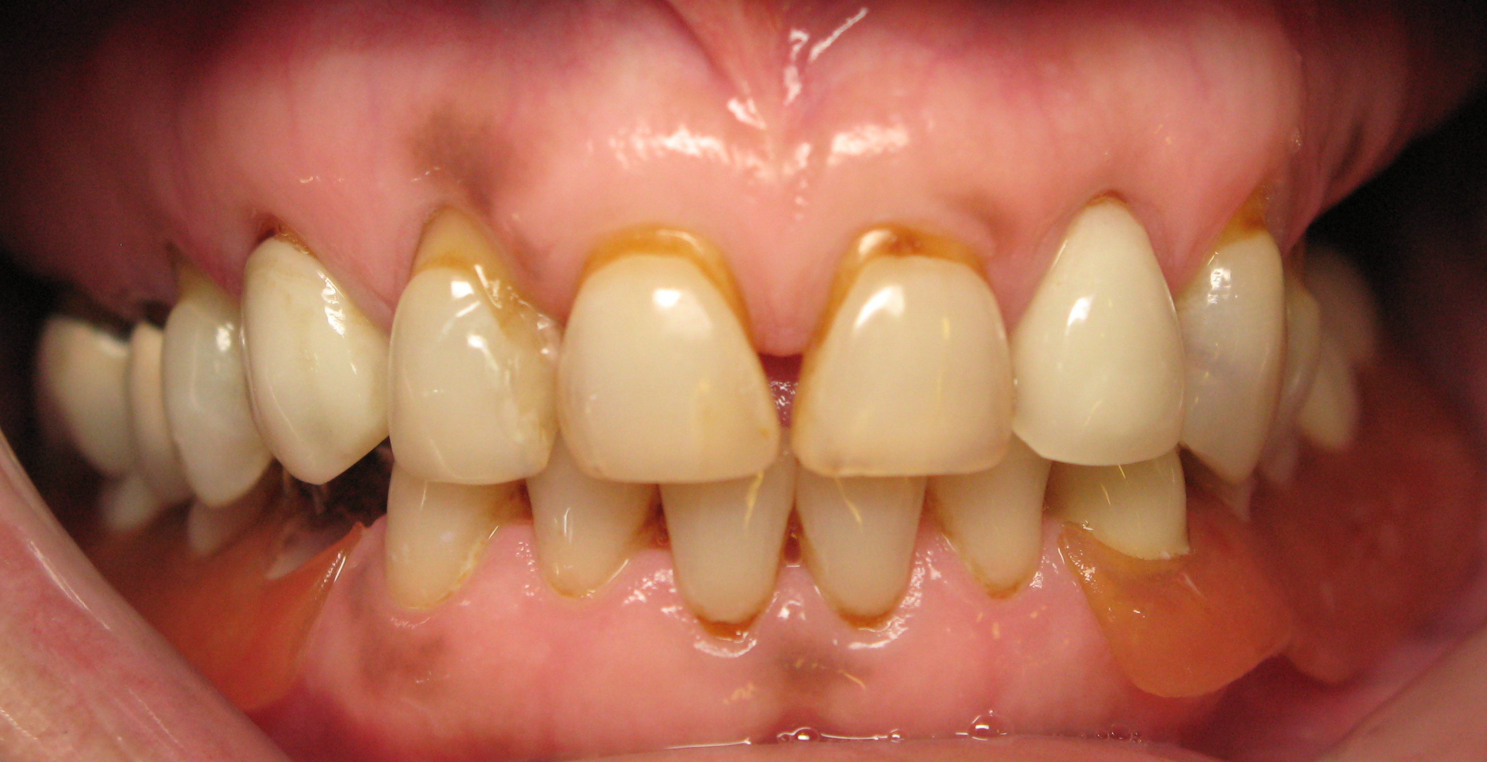 Case Gallery Paul Crawford, DDS