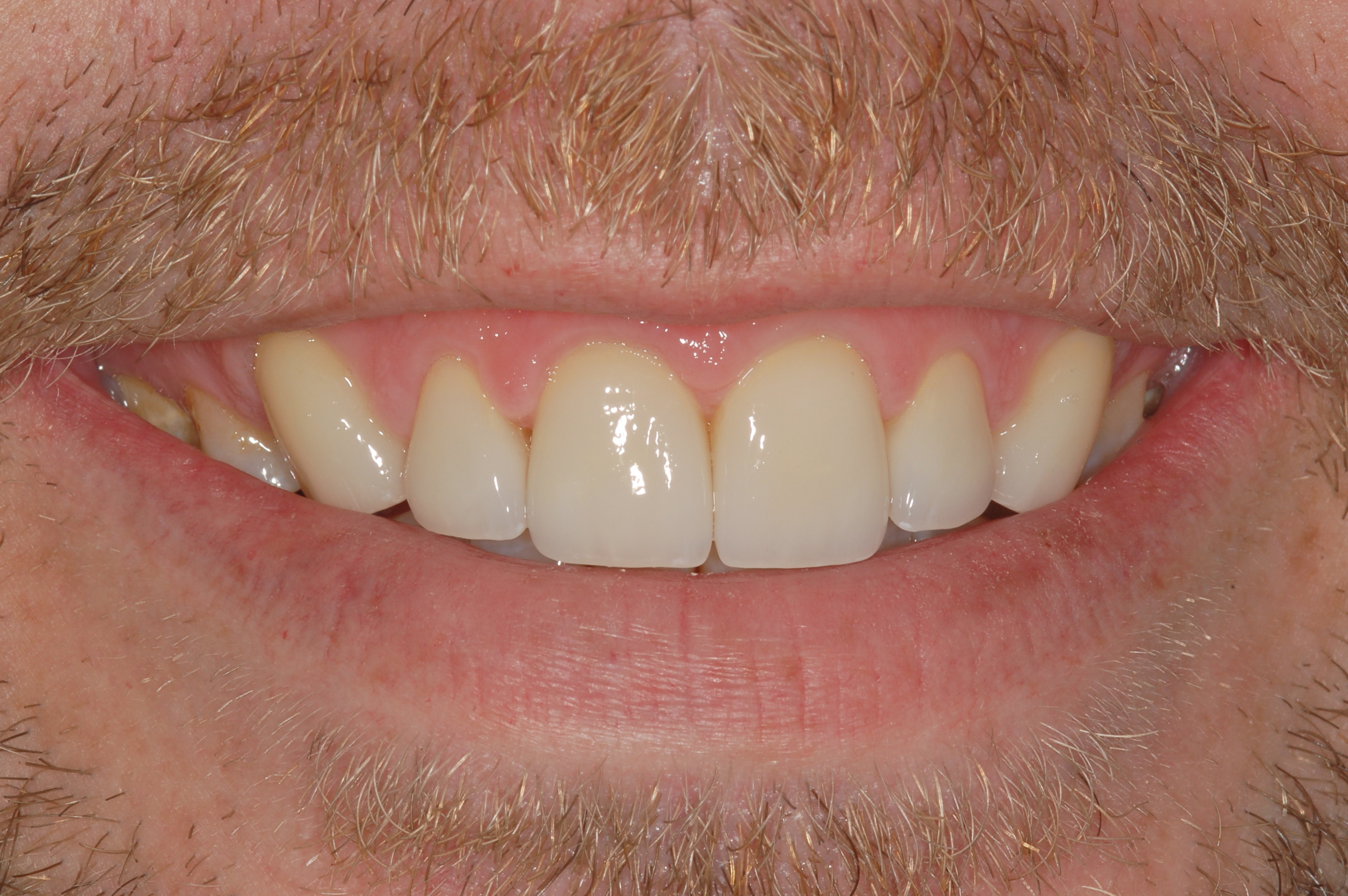 Case Gallery Paul Crawford, DDS