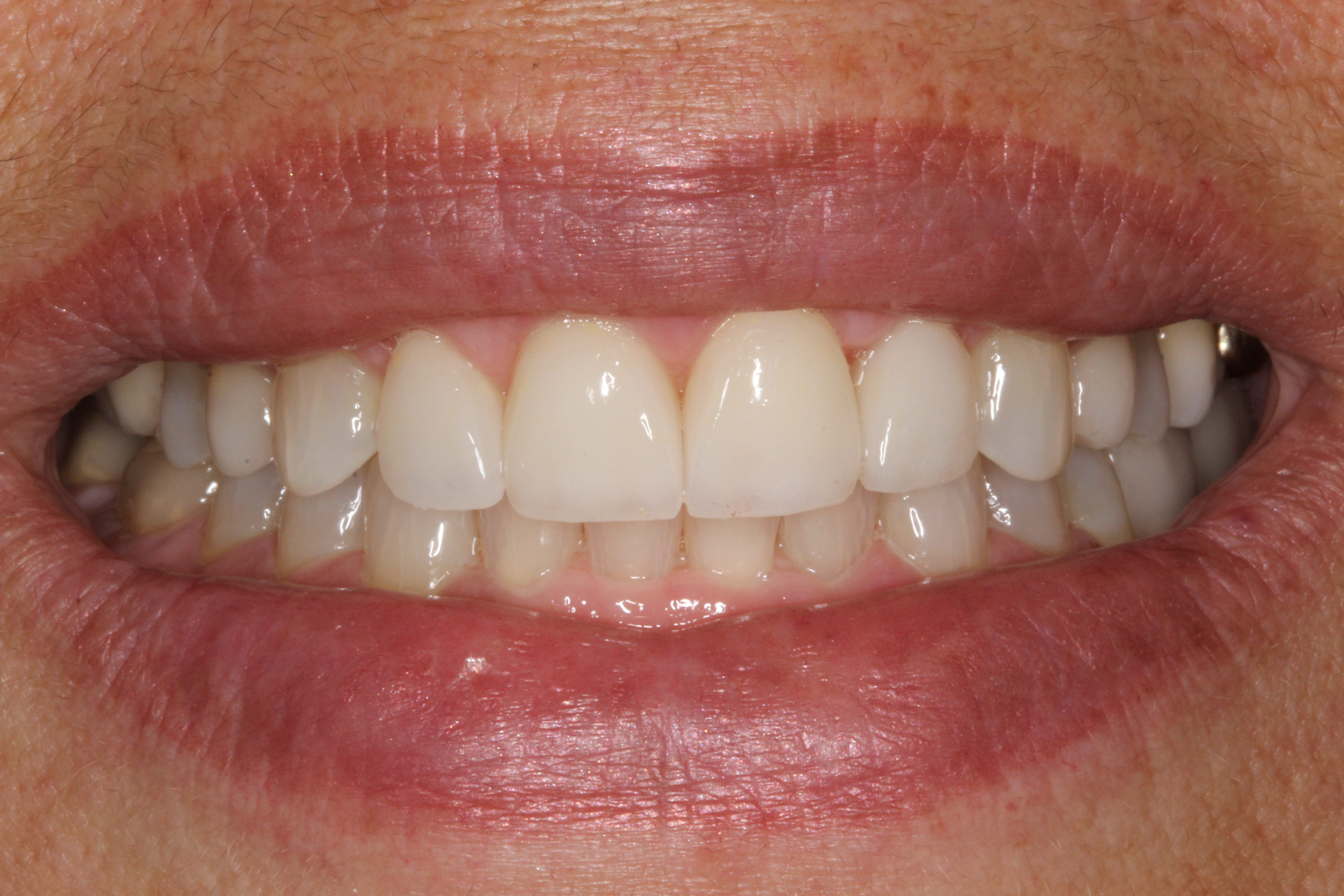 Case Gallery Paul Crawford, DDS